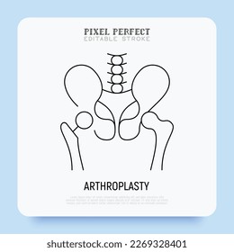 Icono de línea delgada de la artroplastia, articulación artificial, procedimiento quirúrgico para restaurar la articulación. Artritis. Trazo perfecto y editable. Ilustración vectorial. 