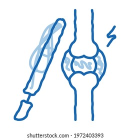 arthroscopy check sketch icon vector. Hand drawn blue doodle line art arthroscopy check sign. isolated symbol illustration