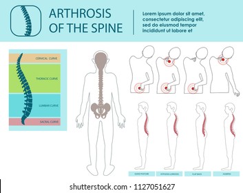 Arthrosis of Spine. Cervical, Thoracic and Lumbar Curves. Icon with Spine Problem. Illustrations of traumatology and orthopedics. Skeleton Spine. Vector Illustration.