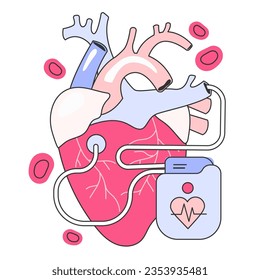 Artificial cardiac pacemaker. Medical device that generates electrical impulses delivered by electrodes to the chambers of the heart. Flat vector illustration