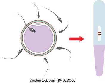 Artificial fertilization of an egg. Pregnancy.