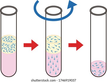 Inseminación artificial (centrifugación de gradiente de densidad)