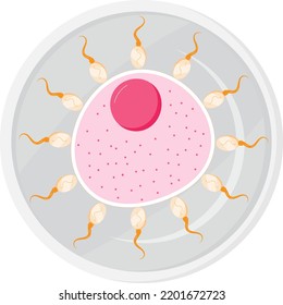 Artificial Insemination Illustartion Vector In Flat Style. Ovary Cell In Petri Dish. IVF Procedure.