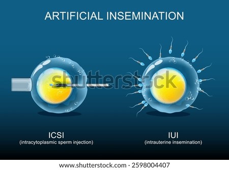 Artificial insemination. Intracytoplasmic sperm injection ICSI and intrauterine insemination IUI. Close-up of egg and sperm during  Assisted reproductive procedure. Sperm donation. Fertility treatment