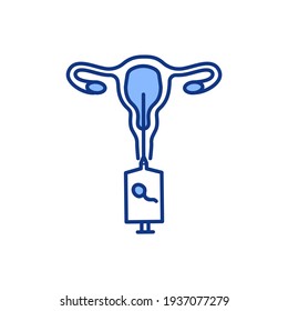 Artificial insemination RGB color icon. Pregnancy achieving. Vivo fertilization. Intentional sperm introduction into female cervix. Infertility treatment method. Isolated vector illustration