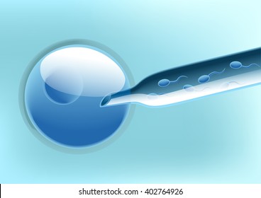 Artificial insemination under a microscope - blue color