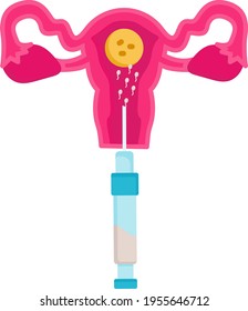 Vektorsymbol für künstliche Befruchtung, In-vitro-Befruchtungssymbol auf weißem Hintergrund, Schwangerschaft und Geburtshilfe, Embryonentransfer-Konzept, Babyprobebild