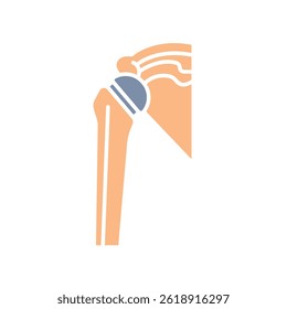 Artificial joint color flat icon for digital and print projects.  Minimal clean icons for apps and websites. Modern simple icons for UI UX and branding