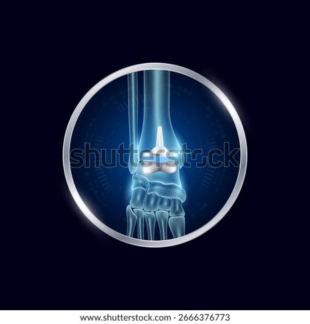 Artificial joints in circle frame label aluminum. Ankle replacement or Prosthetic implant. Orthopedic technology surgery for treatment arthritis damaged cartilage. Medical product vector.