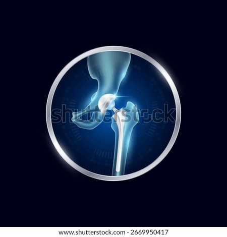 Artificial joints in circle frame label aluminum. Hip replacement or Prosthetic implant. Orthopedic technology surgery for treatment arthritis damaged cartilage. Medical product vector.