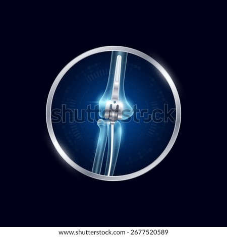 Artificial joints in circle frame label aluminum. Elbow replacement or Prosthetic implant. Orthopedic technology surgery for treatment arthritis damaged cartilage. Medical product vector.
