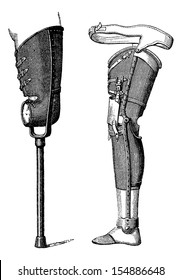 Artificial Legs Non-Bendable at the Knee (left) and Bendable at the Knee (right), vintage engraved illustration. Usual Medicine Dictionary by Dr Labarthe - 1885