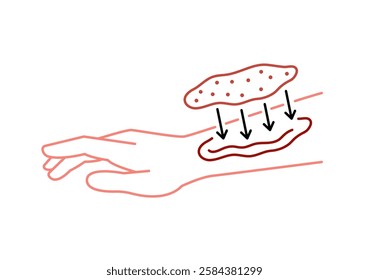 Artificial skin technology linear icon. Editable stroke. Minimalist medical concept. Medical innovation for tissue regeneration and wound healing. Vector illustration isolated on a white background.