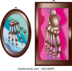 Artistic icon-pictures with hand and foot bones