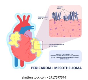 Asbestos Breath Chest Pain Testes Ascites Hydrocele Scrotum Swollen Difficulty Fluid Pleura Testicle Tunica Vaginalis Dust Tract Safe Safety Carcinogen Smoking Hazard Danger Tissue Toxic Silica Copd