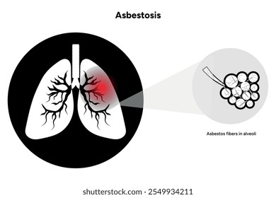 Asbestosis enfermedades pulmonares, problemas pulmonares, icono de pulmones	