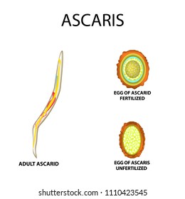 Ascaris the structure of an adult. Fertilized and unfertilized egg. The structure of the egg ascarids. Set. Infographics. Vector illustration on isolated background.