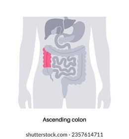 Afiche de colon ascendente. Intestino grueso en el cuerpo humano. Enfermedad gastrointestinal, diagnóstico y tratamiento en la clínica gastroenterológica. Tracto digestivo, examen de la ilustración del vector intestinal