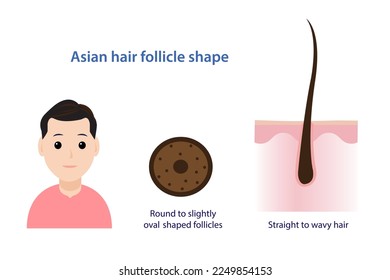 Asian hair follicle shape vector illustration isolated on white background. Cross section of round to slightly oval shaped follicles, straight to wavy hair with scalp layer. Hair anatomy concept.