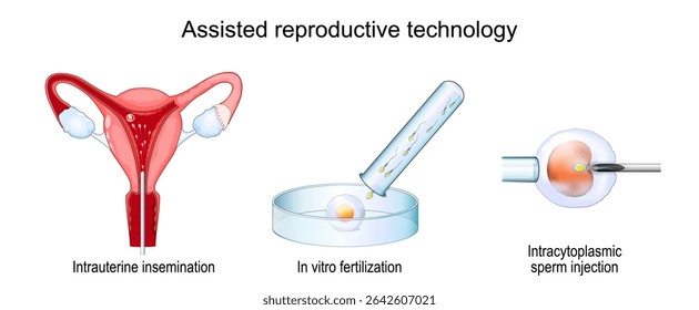 Tecnologia de reprodução assistida. Tratamento de fertilidade. Cartaz Vetor Detalhado