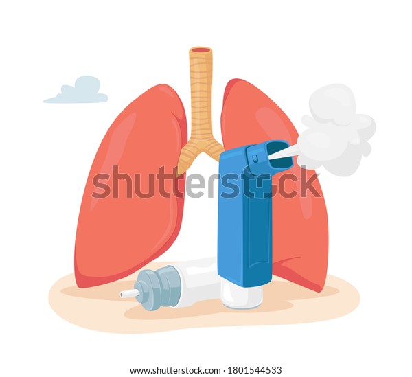 Asthma Disease Concept. Human Lungs and\
Inhaler for Breathing. Chronic Sickness, Respiratory System\
Disease, Medical Equipment, Remedy for Treatment. Pulmonology\
Medicine. Cartoon Vector\
Illustration