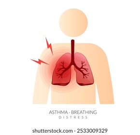 Asma - Pulmões com dificuldade respiratória - ilustração de stock como arquivo EPS 10