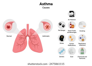 Enfermedad asmática de las vías respiratorias y causas principales