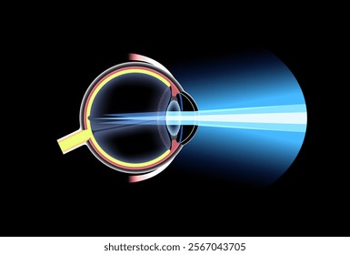 Astigmatism eye disease. Refractive error medical poster. Blurred vision problem at any distance. Visual distortion caused by uneven corneal or lens curvature. Human eye anatomical vector illustration