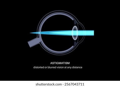 Astigmatism eye disease. Refractive error medical poster. Blurred vision problem at any distance. Visual distortion caused by uneven corneal or lens curvature. Human eye anatomical vector illustration