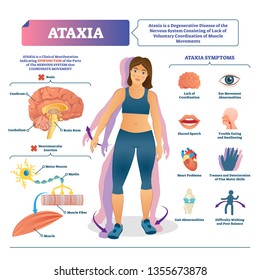 Ataxia vector illustration. Labeled medical movement brain disorder scheme. Neurological problem with cerebellum abnormal illness. Educational diagnosis symptoms list with brain structure infographic.