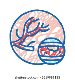 atheroma disease doodle icon sketch vector. atheroma disease sign. isolated symbol illustration