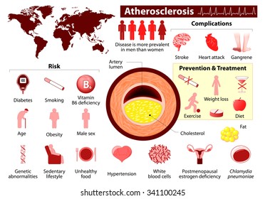 Atherosclerosis. health problems. infographics. elements and icons for design