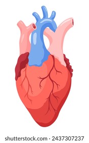 Estadio de ateroesclerosis. Anatomía del ataque cardíaco. Enfermedad vascular arterioesclerótica o AVS. Ilustración vectorial sobre fondo blanco