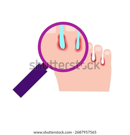 Athlete's Foot disease concept vector illustration
