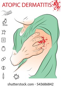 atopic dermatitis. allergies. dermatology. inflammation. man scratches his arm wound. man scratches his arm wound. atypical dermatitis. black and white drawing, drawn by hand