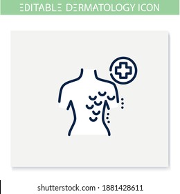 Atopic dermatitis line icon. Skin problem, dermatologic disease. Allergy, eczema. Skincare, cosmetology, medicine. Health and beauty concept. Isolated vector illustration. Editable stroke 