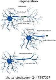 An attempt at nerve fiber regeneration. Damage and degeneration of the nerve fiber. Neuron regeneration.