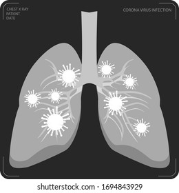 Diseño atractivo y creativo del informe de radiografía de tórax del COVID-19, paciente con virus de la corona en color negro y gris.