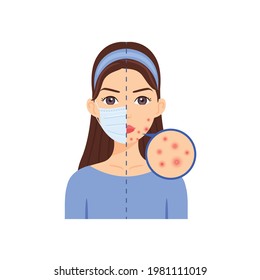 Attractive Girl in a Medical Mask. Pimples, Acne on a Beautiful Face from wearing a medical mask. Problem Skin. Flat color cartoon fashion style. White background. Vector stock illustration.