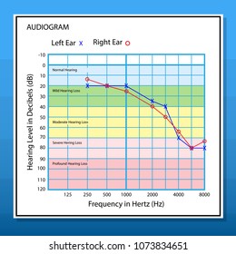 474 Audiogram Images, Stock Photos, 3d Objects, & Vectors 