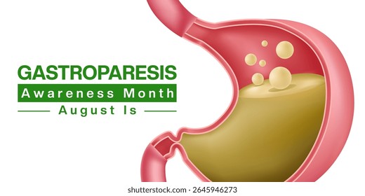 August is Gastroparesis Awareness Month. Stomach. Suitable for posters, banners and social media. White background.