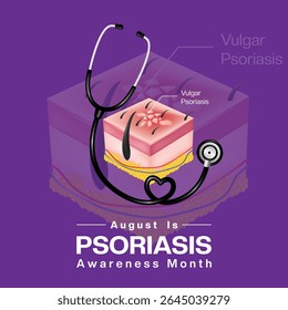 August is Psoriasis Awareness Month. Vulgar psoriasis and stethoscope. Suitable for posters, banners and social media. Purple background.
