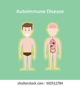 autoimmune disease system illustration with cartoon human man body with protection effect