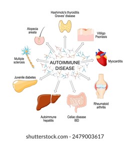 Autoimmune disease. Tissues of the body affected by Autoimmune attack. Human Immune system. Vector poster