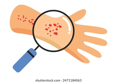 Autoimmune progesterone dermatitis,urticaria,Bullous pemphigoid,herpetiformis,Dermatomyositis,Epidermolysis bullosa acquisita,Gestational,Hidradenitis suppurativa,Lichen planus,Linear IgA,Psoriasis