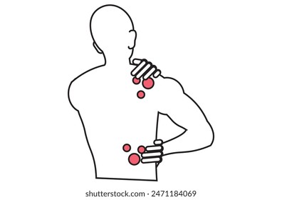 Autoimmune progesterone dermatitis,urticaria,Bullous pemphigoid,herpetiformis,Dermatomyositis,Epidermolysis bullosa acquisita,Gestational,Hidradenitis suppurativa,Lichen planus,Linear IgA,Psoriasis