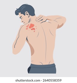 Autoimmune progesterone dermatitis,urticaria,Bullous pemphigoid,herpetiformis,Dermatomyositis,Epidermolysis bullosa acquisita,Gestational,Hidradenitis suppurativa,Lichen planus,Linear IgA,Psoriasis