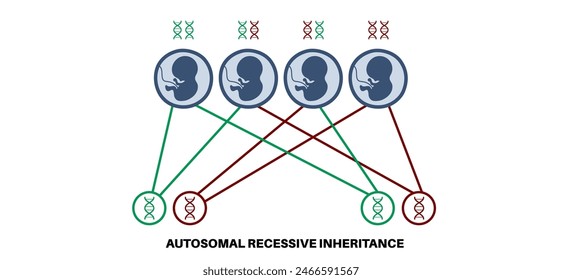 Autosomal-rezessives Vererbungsmuster. Kind erbt eine Kopie eines mutierten Gens von jedem Elternteil. Genetische Erkrankung oder Störung. Betroffene, Träger oder gesunde X- und Y-Chromosomen-Vektorillustration.