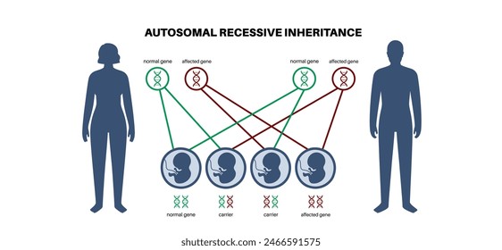 Autosomal recessive inheritance pattern. Child inherits one copy of a mutated gene from each parent. Genetic disease or disorder. Affected, carriers or healthy X and Y chromosomes vector illustration.