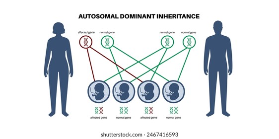 Autosomal-rezessives Vererbungsmuster. Kind erbt eine Kopie eines mutierten Gens von jedem Elternteil. Genetische Erkrankung oder Störung. Betroffene, Träger oder gesunde X- und Y-Chromosomen-Vektorillustration.